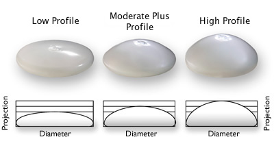 breast implant sizes