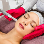 Beautiful woman receiving microneedling rejuvenation treatment