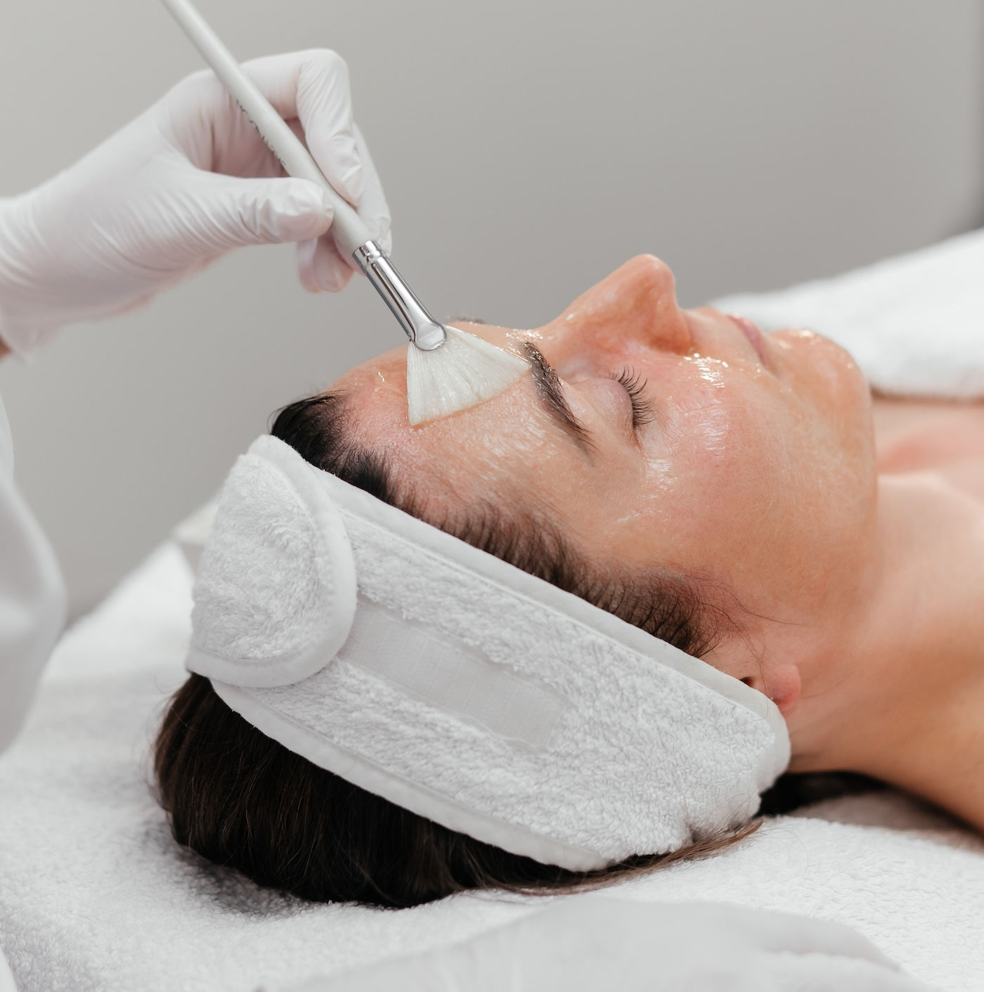 woman receiving chemical peel treatment