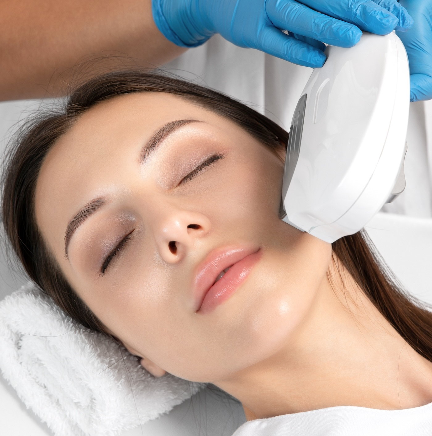 woman receiving ipl photofacial