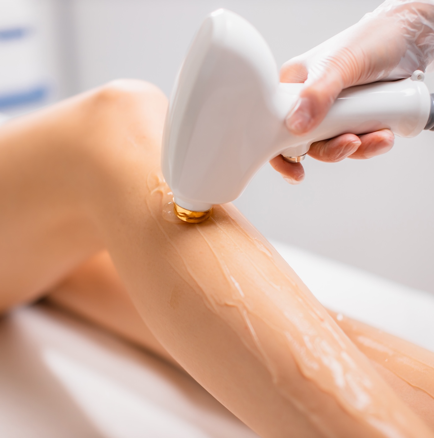 woman receiving laser hair removal treatment