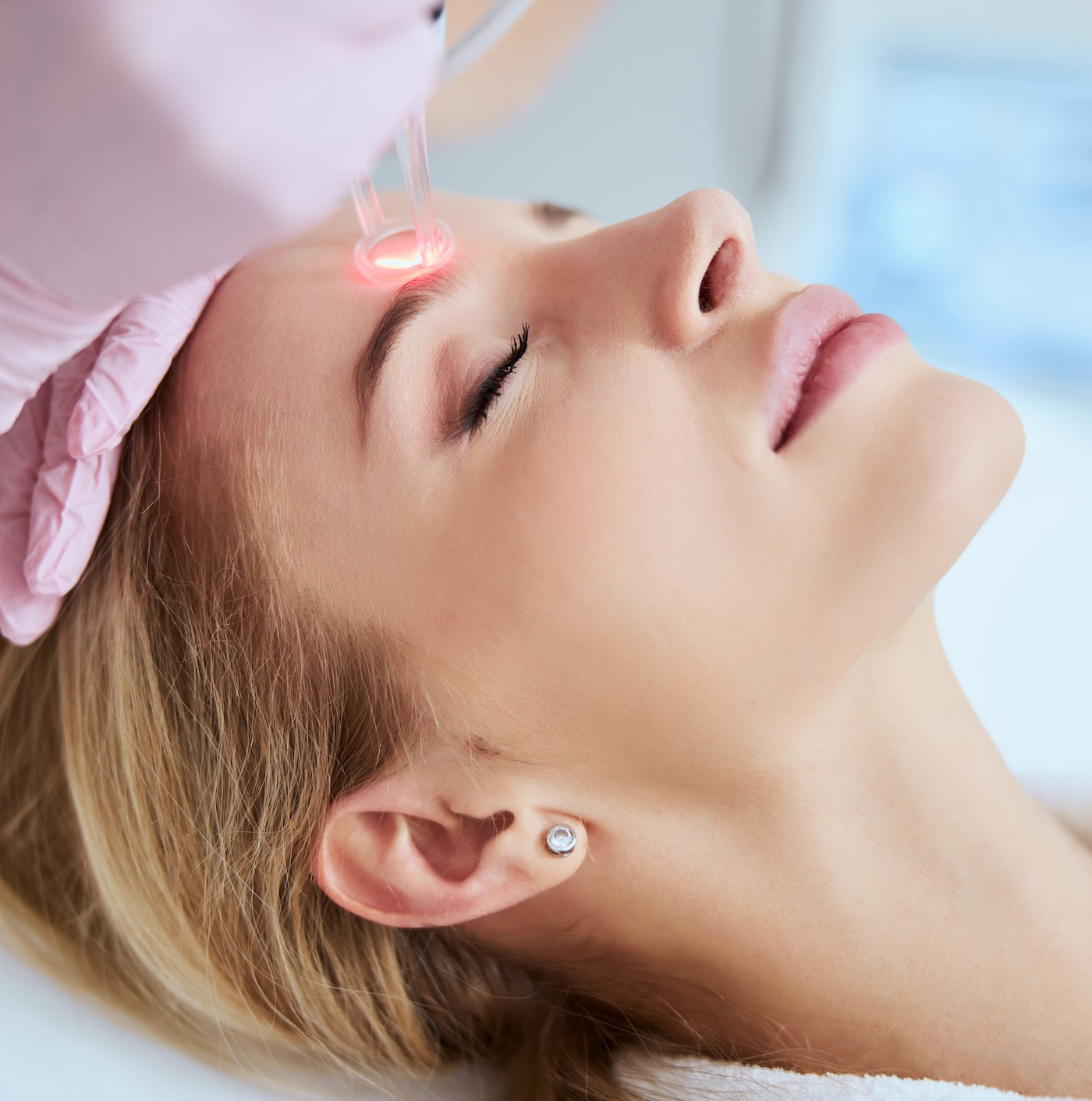 woman receiving laser resurfacing treatment